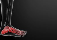 Co oznacza ból stopy? Przyczyny dolegliwości mogą leżeć w całej anatomii stopy
